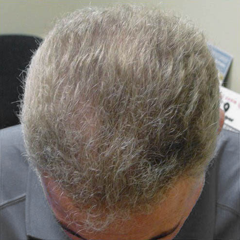 gilbertmedspa - Before Treatment