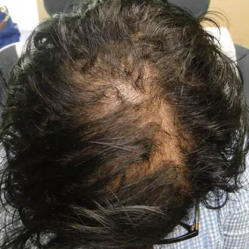 gilbertmedspa - Before Treatment