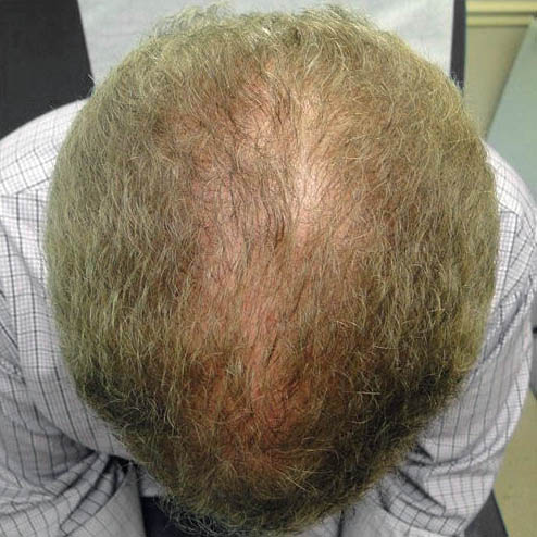 gilbertmedspa - Before Treatment